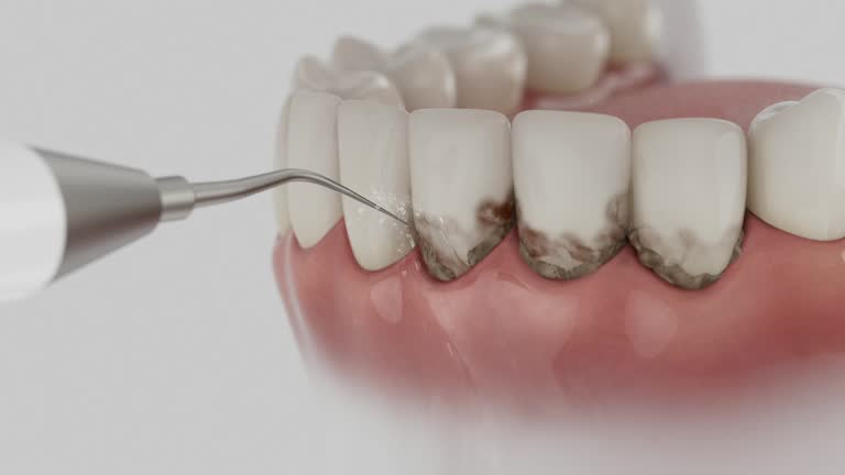 Reliable Dental Implants contractor in Milton, FL by Smile Center Dentistry
